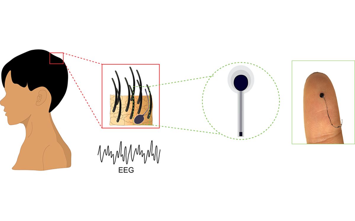Investigadores de Penn State han desarrollado un nuevo electrodo para electroencefalografía que se asemeja a un cabello y mejora la calidad del monitoreo cerebral de manera discreta y cómoda